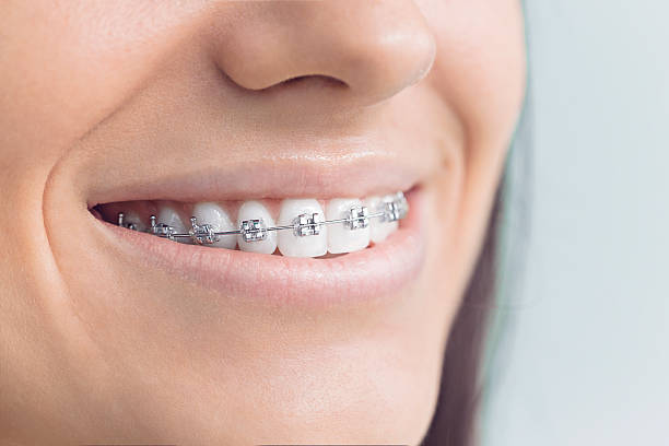 Best Wisdom Tooth Removal  in Woodburn, VA